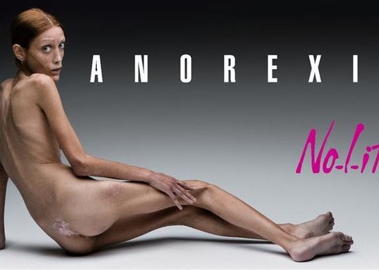  Anorexie : l’apologie bientôt un délit et les mannequins trop maigres au chômage ?